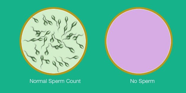 Best Medicine For Azoospermia In Nagpur