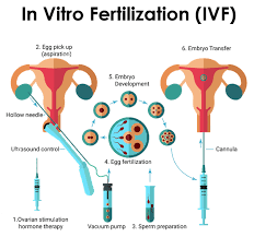Best IVF Specialist In Nagpur