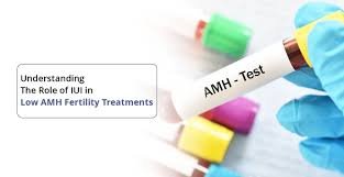 Female Infertility Treatment For Low AMH In Nagpur