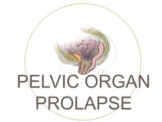 Pelvic organ prolapse surgery in nagpur