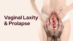 Vaginal Laxity Treatment In Nagpur