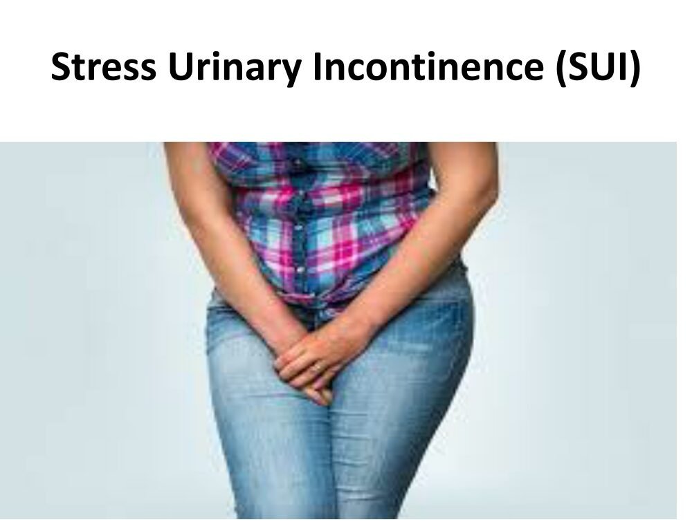 stress-urinary-incontinence SUI In Nagpur