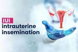 Best IUI Center In Jabalpur