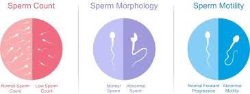 Low Sperm Motility & Morphology Treatment in Jabalpur | Dr. Ankita Malewar