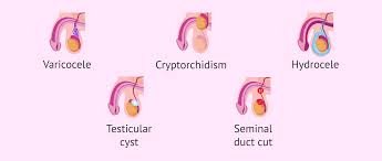Medicine For Oligospermia In Raipur